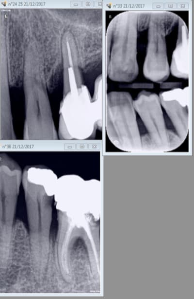 Capture d écran 2017 12 21 09.45 - Eugenol