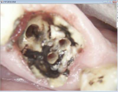 Capture d écran 2018 02 26 23.43 - Eugenol