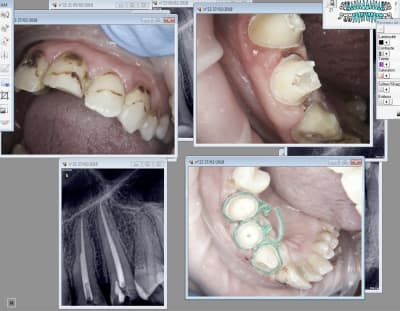 Capture d écran 2018 02 27 15.19 - Eugenol