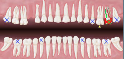 Capture d e cran 2015 04 30 22.46 - Eugenol