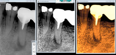 Capture d e cran 2015 04 30 23.53 - Eugenol