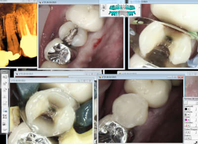 Capture d e cran 2015 10 26 21.00 - Eugenol