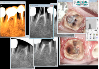 Capture d e cran 2016 04 13 22.41 - Eugenol