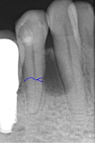 Capture mzqzgo - Eugenol