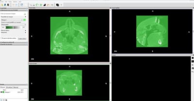 Capture u3e1dp - Eugenol