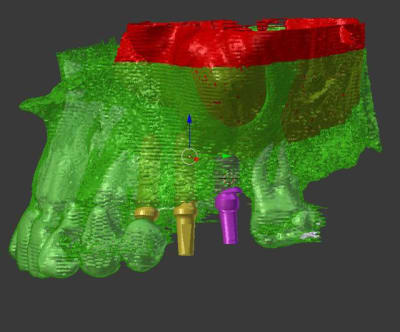 Capture vct4w9 - Eugenol