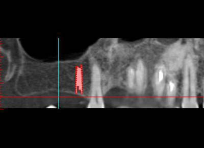 Capture wil1 mawliy - Eugenol