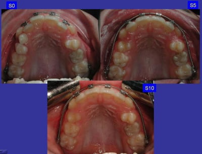 Capturer 5 3 l2ykm2 - Eugenol