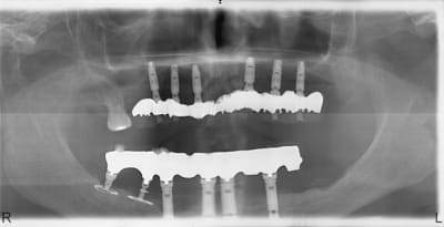 Carpinelli3 mfz6nt - Eugenol