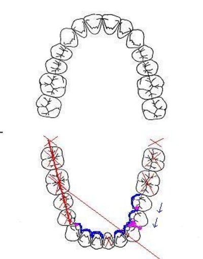 Cas clinique ttlzb7 - Eugenol
