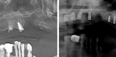 Cas rkavus - Eugenol