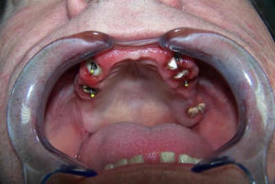 Claudec extrao3 ddumoh - Eugenol