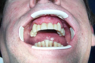 Claudec extrao fd0wmg - Eugenol