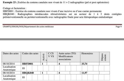 Code 4 avec endo  radio rczazu - Eugenol