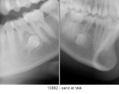Copie de 10882 07 01 15 tter wmorlt - Eugenol