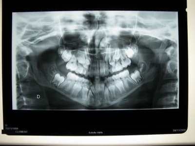 Copie de  clement pano 006 vwue67 - Eugenol