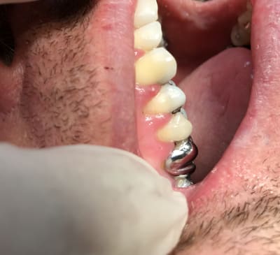 D175ec91 dd1a 4914 b1b5 5a4c09656a05 nlyees - Eugenol