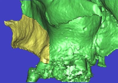 Dar3d4 rfpdu1 - Eugenol