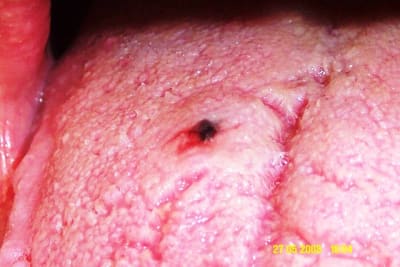 Dcp 0322 nph1bl - Eugenol