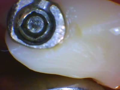 Demo patient1 2020 03 12 184951 nh2bjl - Eugenol