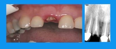 Depose  qbaej0 - Eugenol