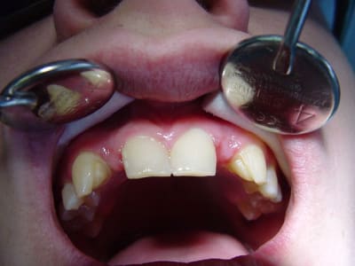 Dsc00088 s3ie5k - Eugenol