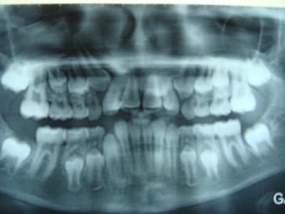 Dsc00783 ibbacs - Eugenol