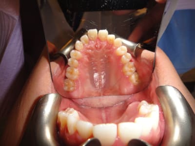 Dsc00868 g4hdz6 - Eugenol