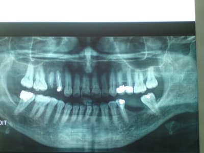 Dsc01261 nkqzkt - Eugenol