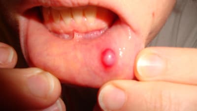 Dsc02341 lhpdau - Eugenol