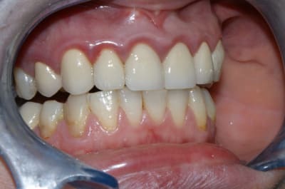 Dsc02701 uzdbee - Eugenol