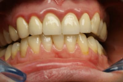 Dsc02703 rlkmgs - Eugenol