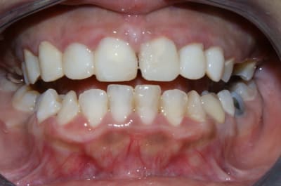 Dsc03357 xnqxdz - Eugenol