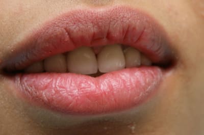 Dsc03390 kuwt0d - Eugenol