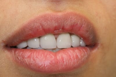 Dsc03391 azkxbk - Eugenol