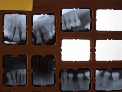 Dsc04555 j8ugzl - Eugenol