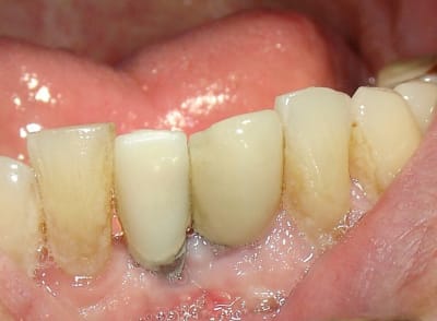 Dsc05188 mhn35s - Eugenol