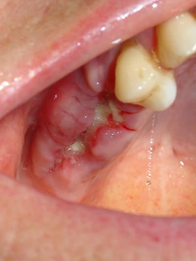 Dsc05606 yvhbd9 - Eugenol