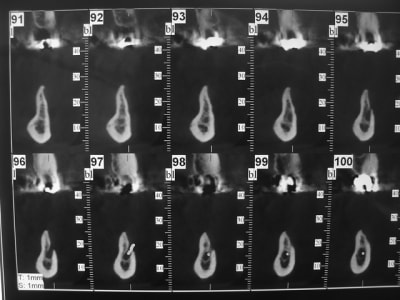 Dsc05918 mvy6lu - Eugenol