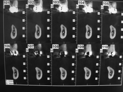 Dsc05919 bwzsrw - Eugenol