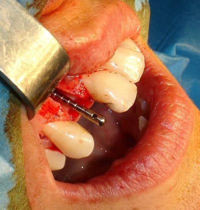 Dsc06149 wmlcmc - Eugenol