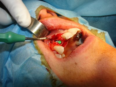 Dsc06161 p2wbd8 - Eugenol