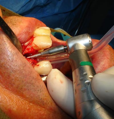 Dsc09763 lcemcr - Eugenol