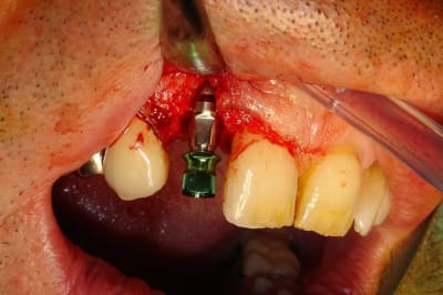 Dsc09765 hp5kna - Eugenol