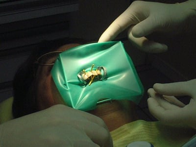 Dscf0021 xnsjti - Eugenol