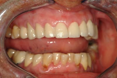 Dscf0070 odzx5v - Eugenol