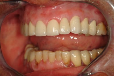 Dscf0071 ky6vhn - Eugenol