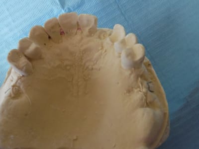 Dscf0357 2 ogzlua - Eugenol