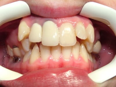 Dscf2444 xulxea - Eugenol