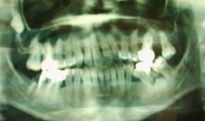 Dsci0003 bdmg3b - Eugenol